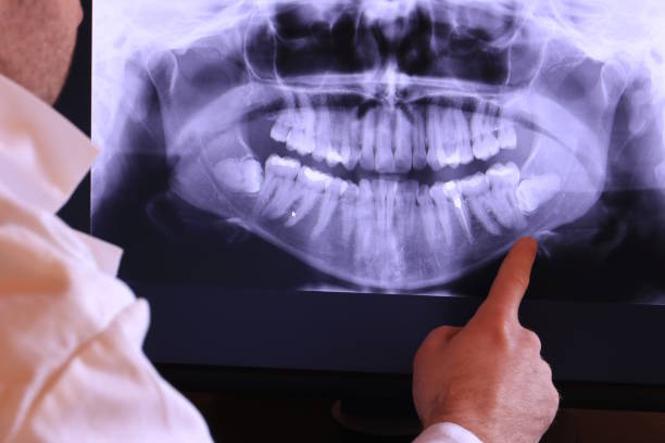 Best Broken or Cracked Tooth Emergency Dentist in Dalton, PA
